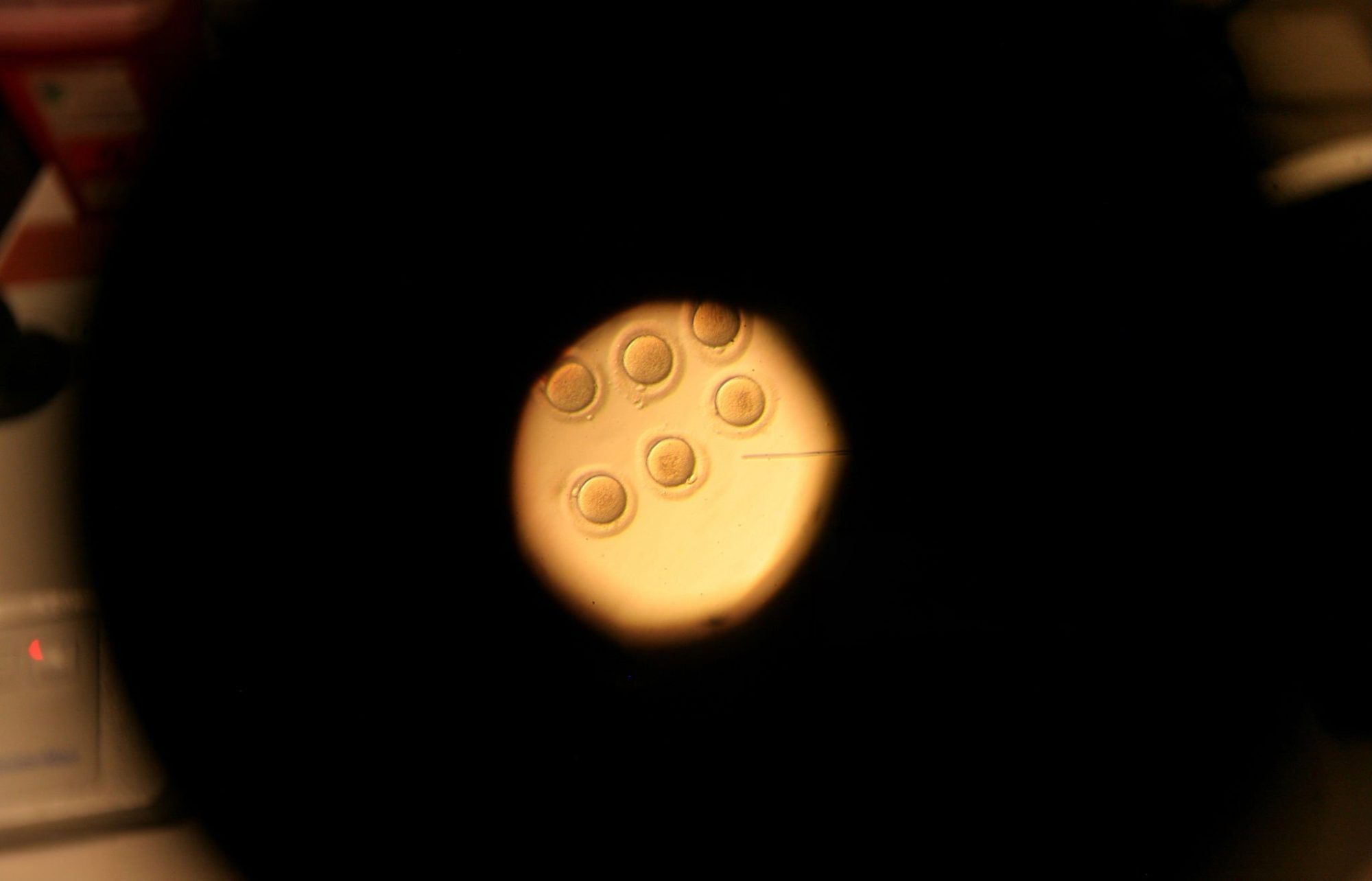IVF embryo viability